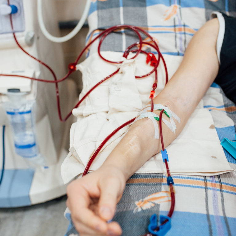 Como Sentarse Con Una Fístula Complicaciones del acceso vascular temporal de hemodiálisis
